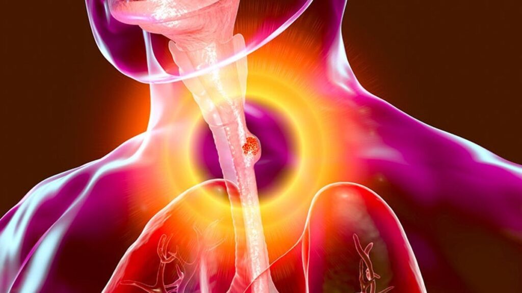 Patient undergoing minimally invasive esophageal cancer surgery with advanced laparoscopic or robotic techniques.