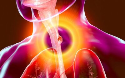 Patient undergoing minimally invasive esophageal cancer surgery with advanced laparoscopic or robotic techniques.